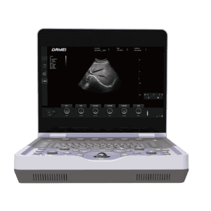 LSDW-L30-Professional-Laptop-Color-Doppler-Ultrasound-System-Mobile-Diagnosis