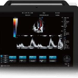 LSDW-P80 Color Ultrasound