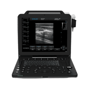 LSDW-P50-Professional-Portable-Color-Doppler-Ultrasound-System-Bedside-Care